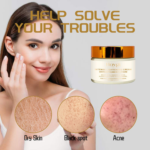 Intense Lightening Cream for Dark Spots & Uneven Tone