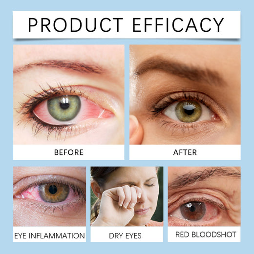 Eye Drops for Dry Screen-Tired Eyes - Fast Soothing Relief