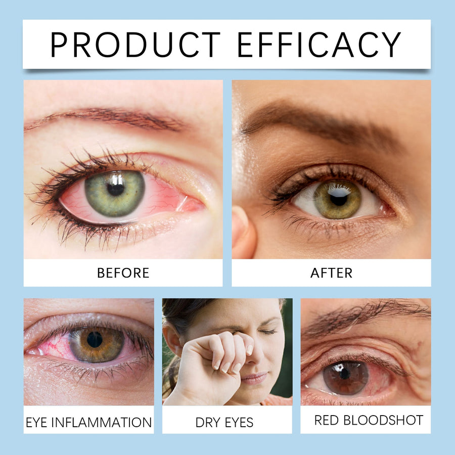 Eye Drops for Dry Screen-Tired Eyes - Fast Soothing Relief
