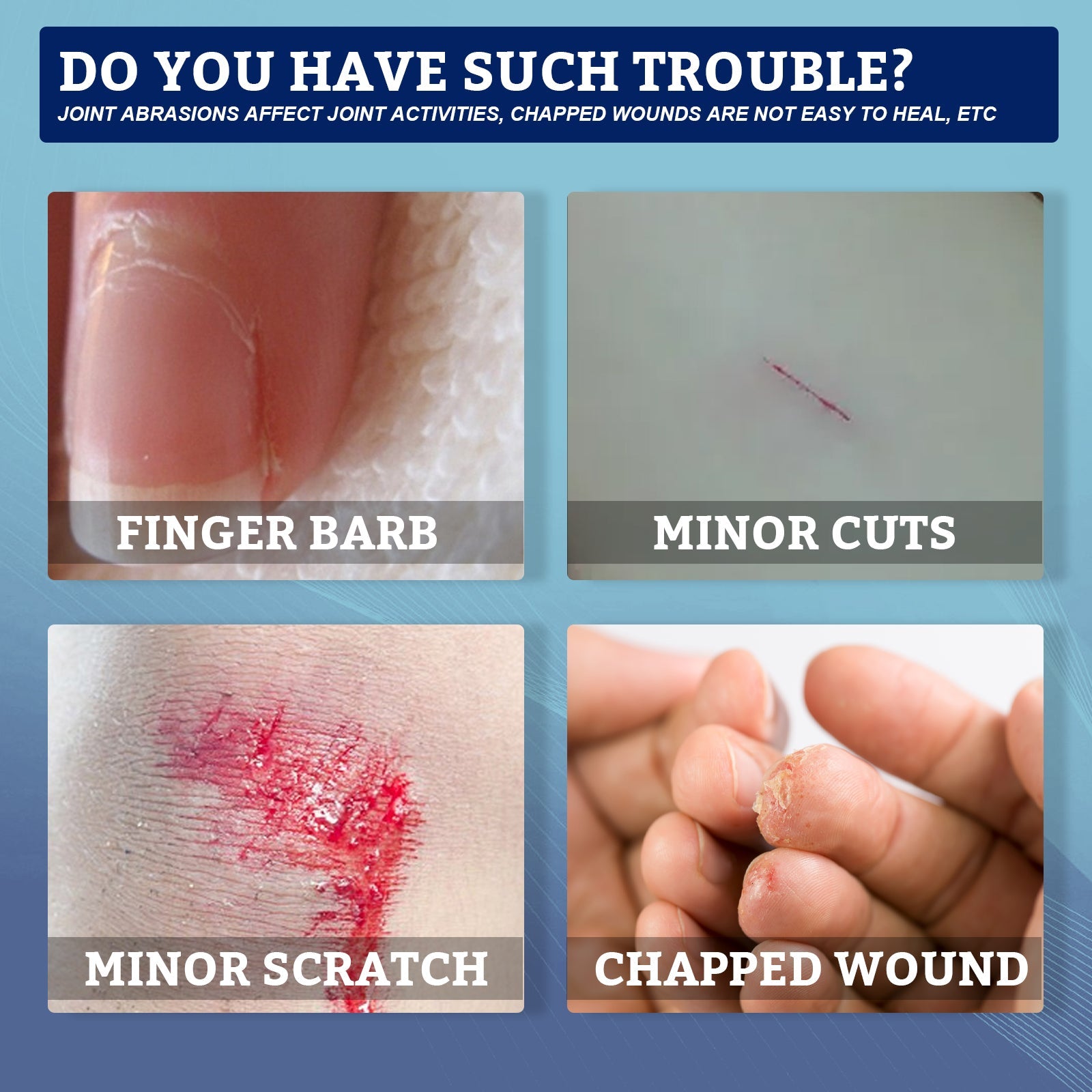 Hands demonstrating application of liquid band aid to a wound on palm