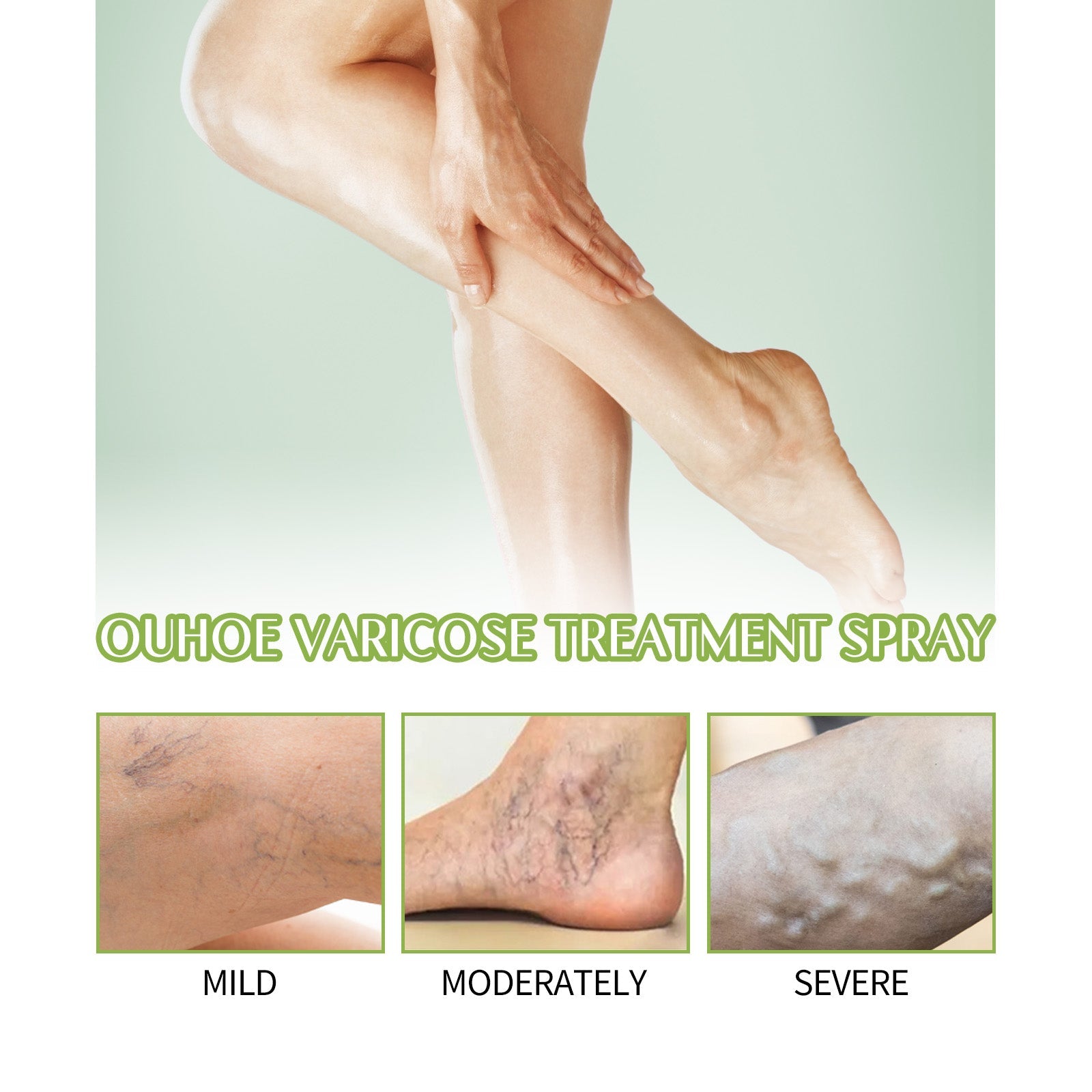 OUHOE VeinsCare Varicose Treatment Spray product box and bottle side-by-side