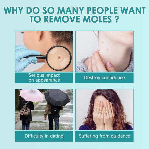 Hydrocolloid Blemish Patches - Invisible Acne Spot Treatment