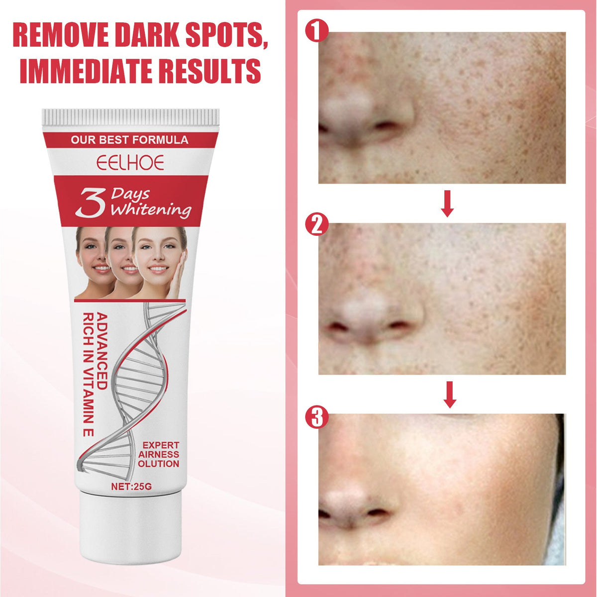 Vitamin E Facial Cream for Dark Spots & Uneven Tone