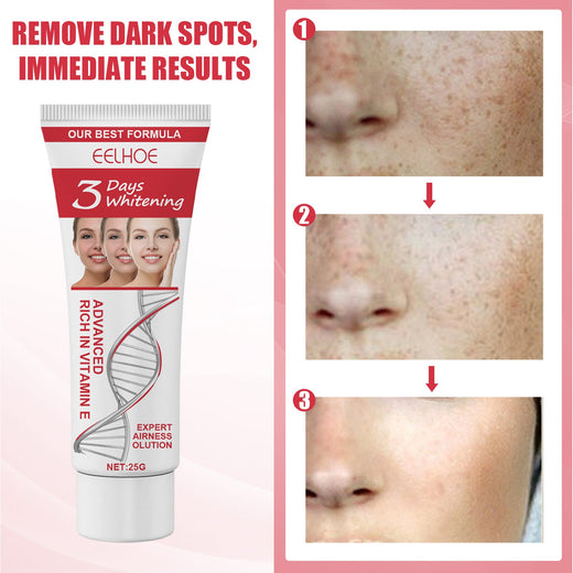 Vitamin E Facial Cream for Dark Spots & Uneven Tone