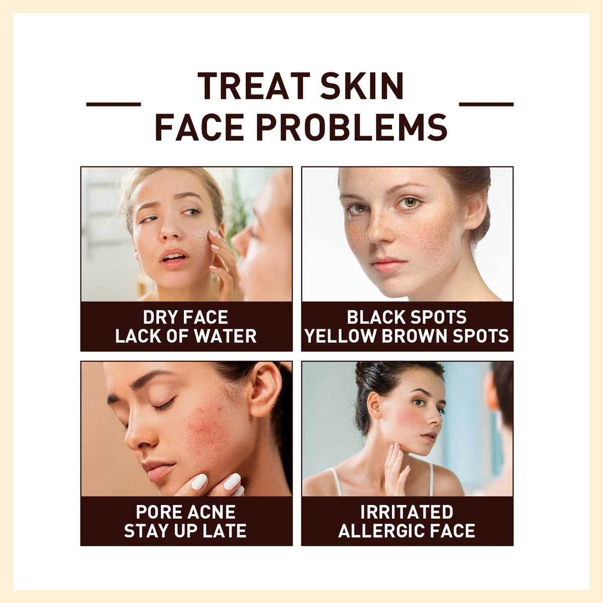 Rice Anti Wrinkle Essence for Brighter Firmer Skin