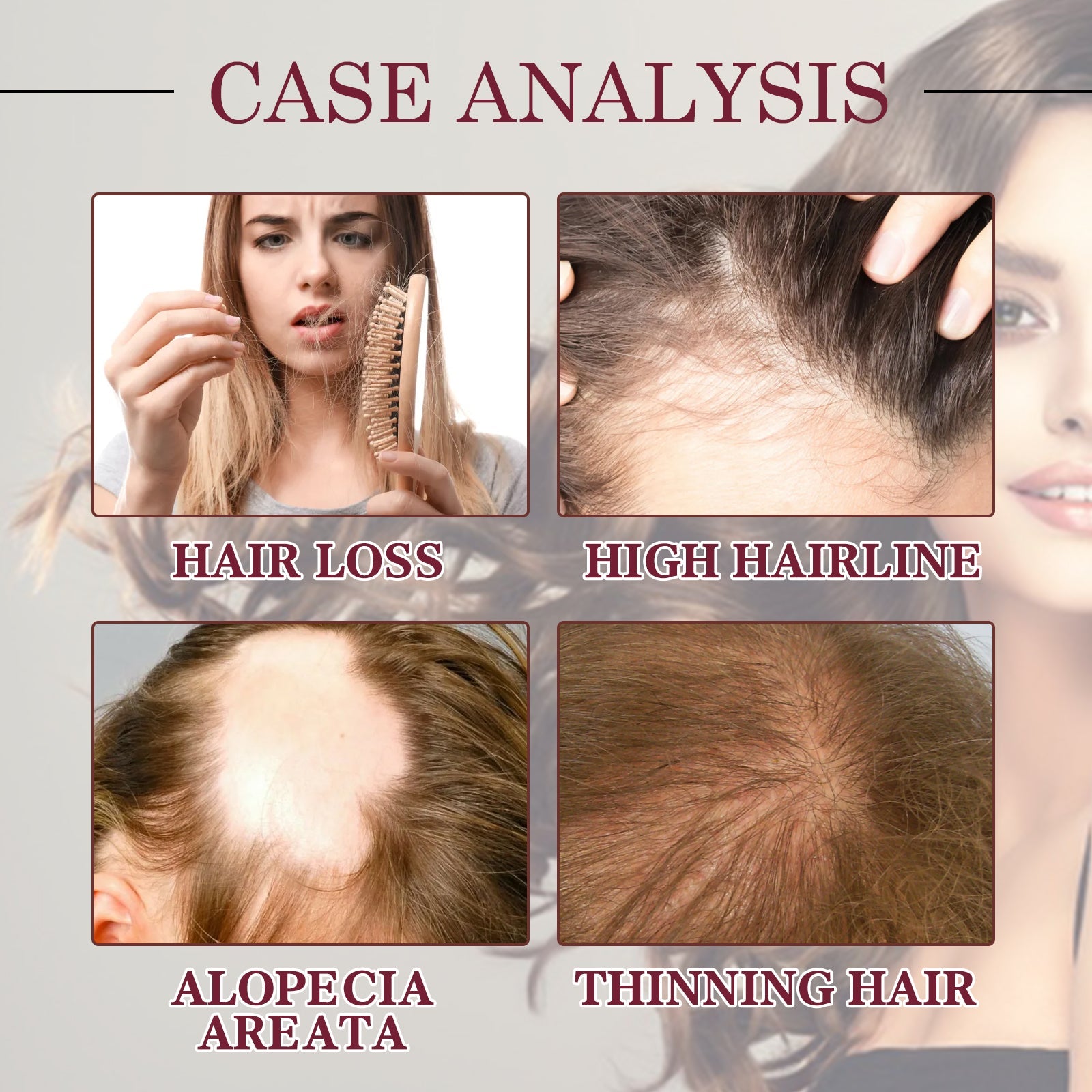 Case analysis grid showing four scalp conditions: hair loss, high hairline, alopecia areata, thinning hair with visible comparisons
