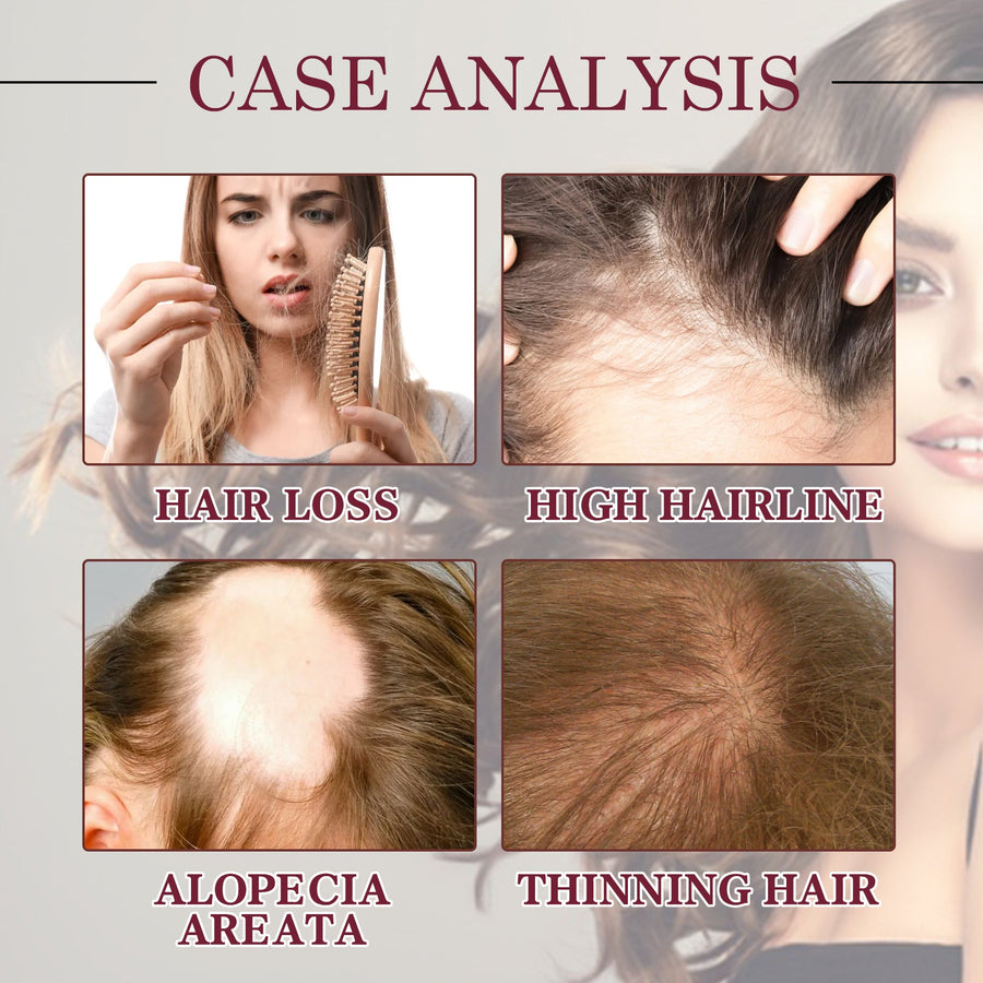 Onion Oil for Hair Growth — Stop Thinning, Boost Volume