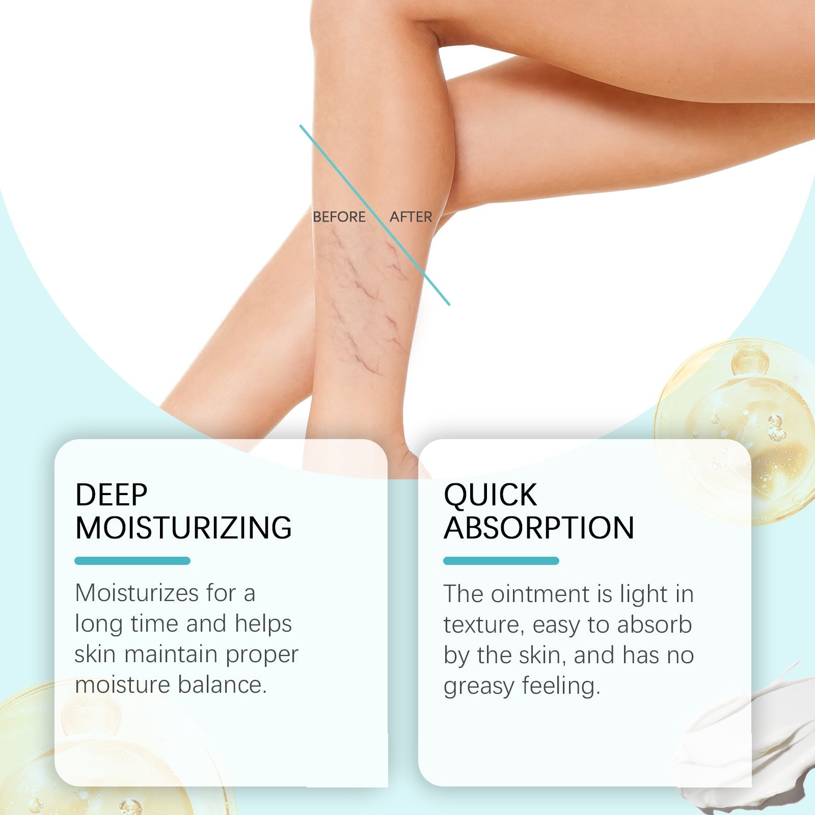 Side-by-side comparison of leg showing before state with visible veins and after state with smoother, clearer appearance