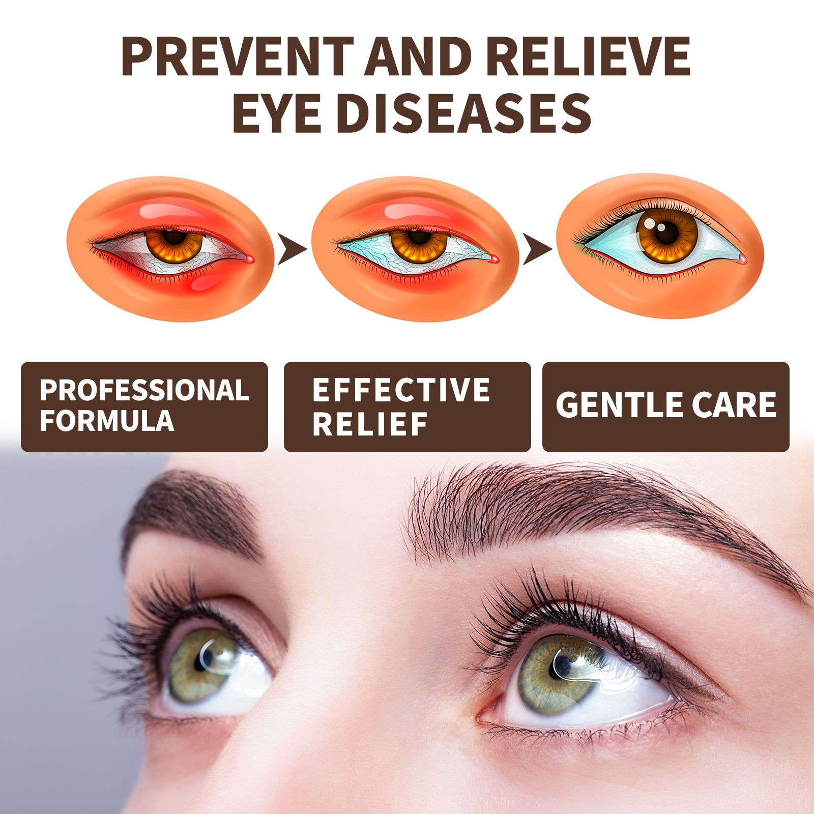 Three illustrated eye disease progression stages showing severe inflammation transitioning to healthy clear eyes, with text 'Professional Formula, Effective Relief, Gentle Care'