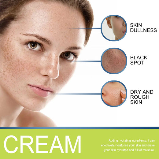 Correcting Cream for Dark Spots, Freckles & Melasma