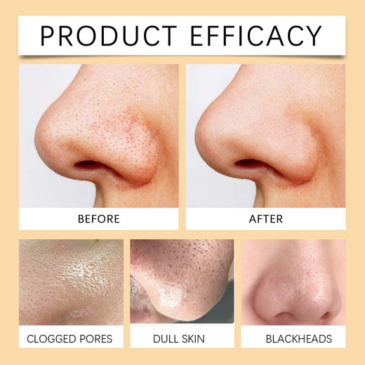 Enzyme Exfoliating Gel for Clogged Pores & Blackheads