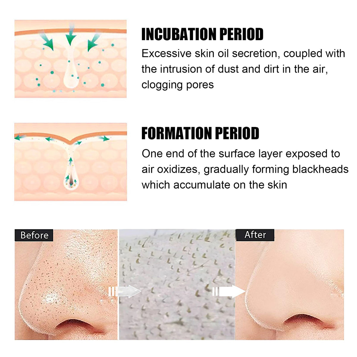 Peel-Off Blackhead Mask With Green Tea for Clear Pores