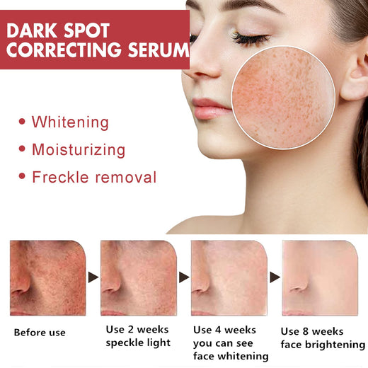Dark Spot Serum with Niacinamide 10% and TXA 4%