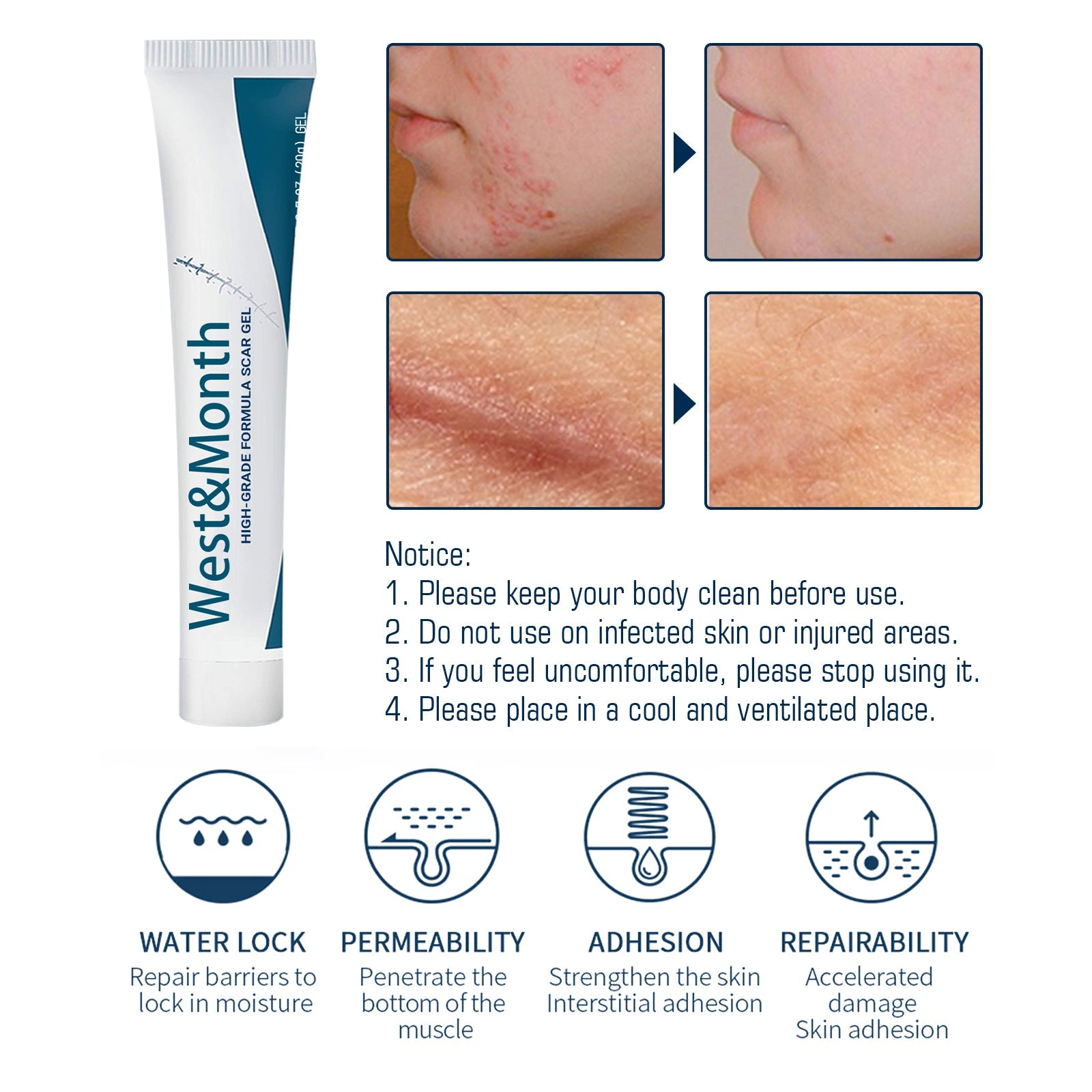Four before/after close-ups showing facial acne scars and body surgical scars with visible redness reduction and smoothing