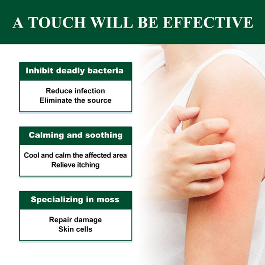 Skin Repair Cream for Shingles Itch & Rash Relief