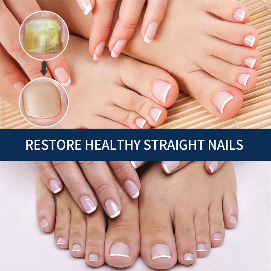 Nail Repair Essence Pen — Restores Healthy Nails from