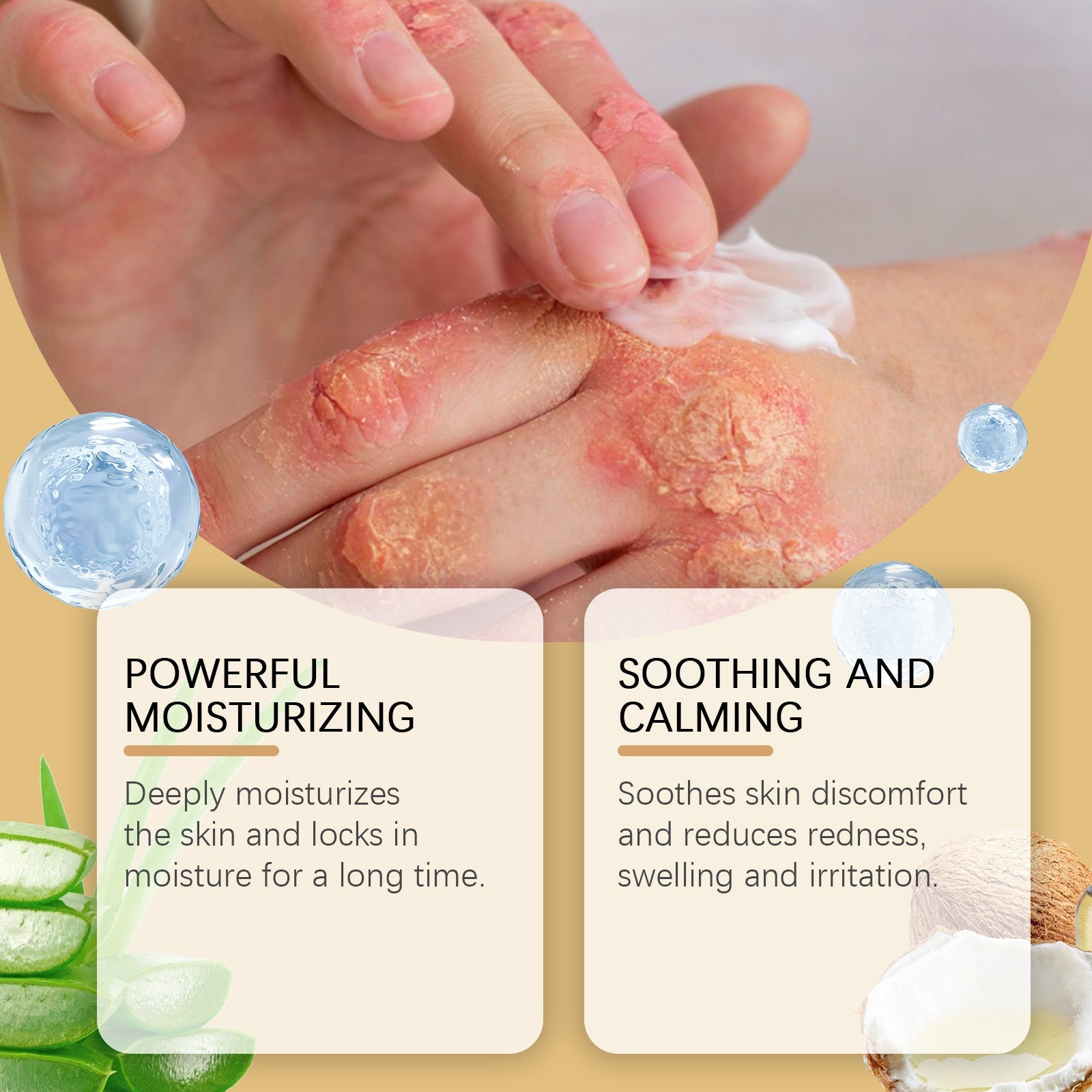 Before/after demonstration showing irritated, red, flaky skin with cream being applied and benefit callouts for moisturizing and soothing