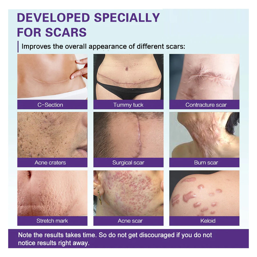 Silicone Scar Gel — Visible Reduction for All Scar Types