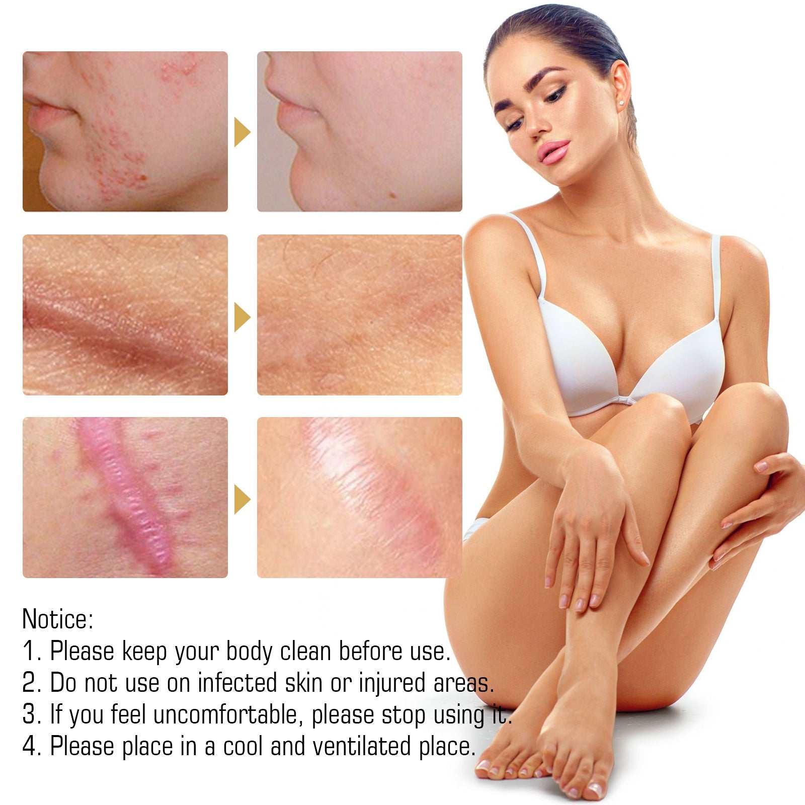 Three rows of before/after comparisons showing acne scars, stretch marks, and surgical scars with visible improvement, plus lifestyle image of confident woman
