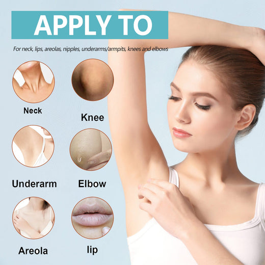 Acanthosis Nigricans Cream for Dark Underarms & Creases