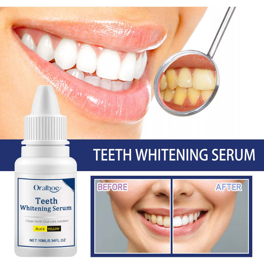 Teeth Whitening Serum — Visibly Whiter Teeth in Days