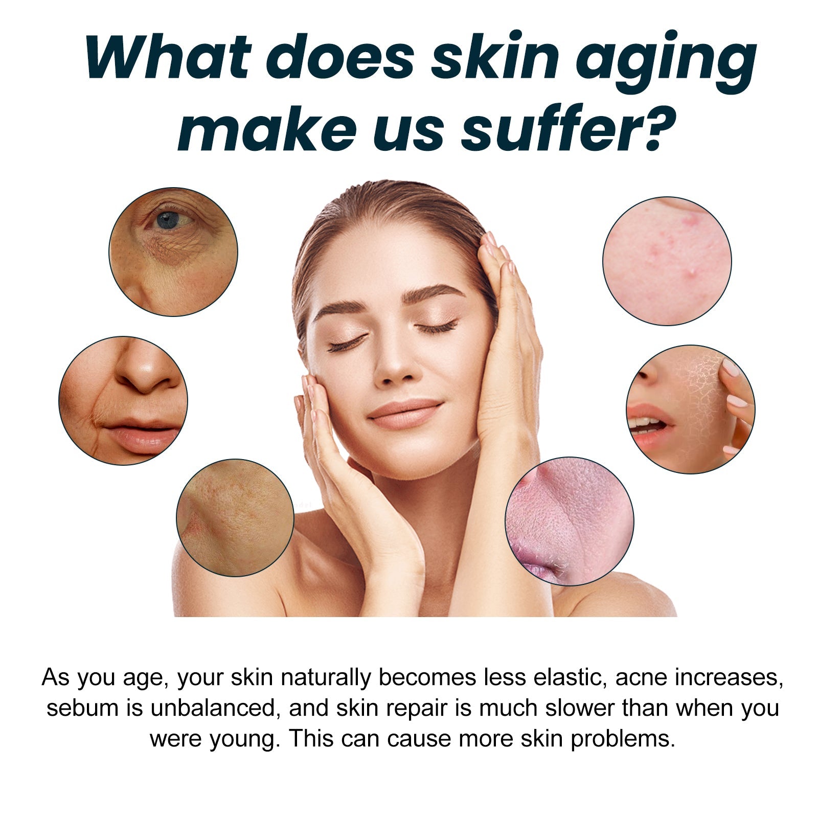 Educational infographic showing skin aging problems with close-up circles of wrinkles, acne, sagging, and loss of elasticity surrounding a woman's face