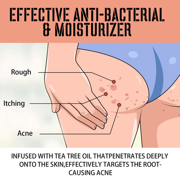 Buttock Care Cream for Dark Spots & Rough Skin