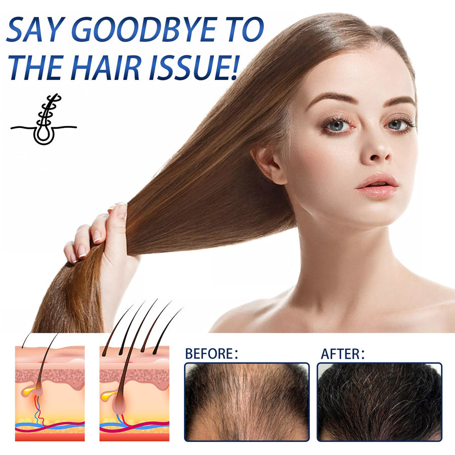 Ginseng Hair Regrowth Spray — Thicker, Fuller Hair in 8 Weeks