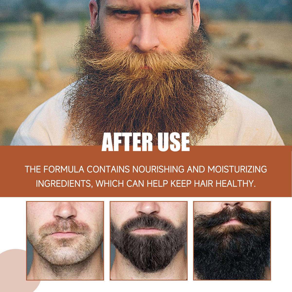 Facial Hair Serum — Thicker, Fuller Beard in 8 Weeks