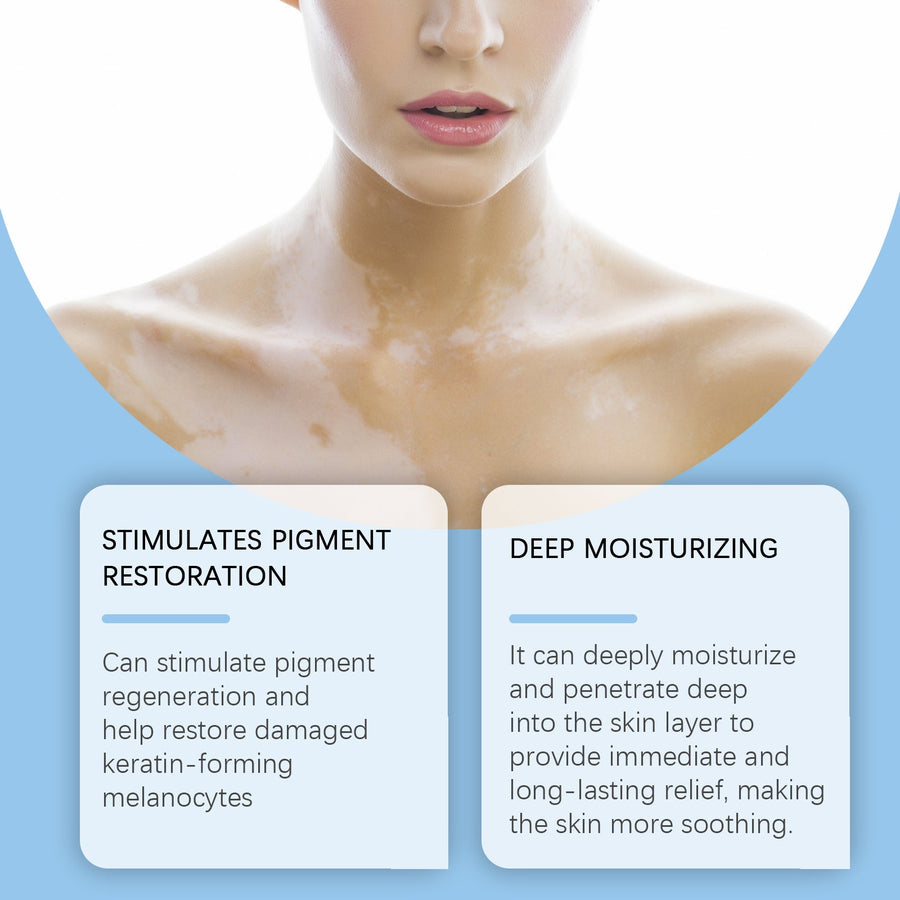 Vitiligo Cream — Stimulates Pigment Restoration & Deep