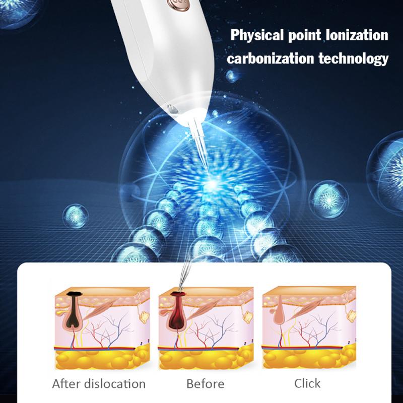 Plasma Pen Skin Care Applicator