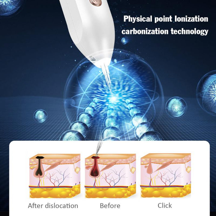 Plasma Pen — Skin Tag & Mole Removal, Zero Pain & Scarring