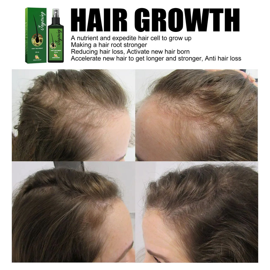 Scalp Hair Growth Spray for Thinning Hair Support