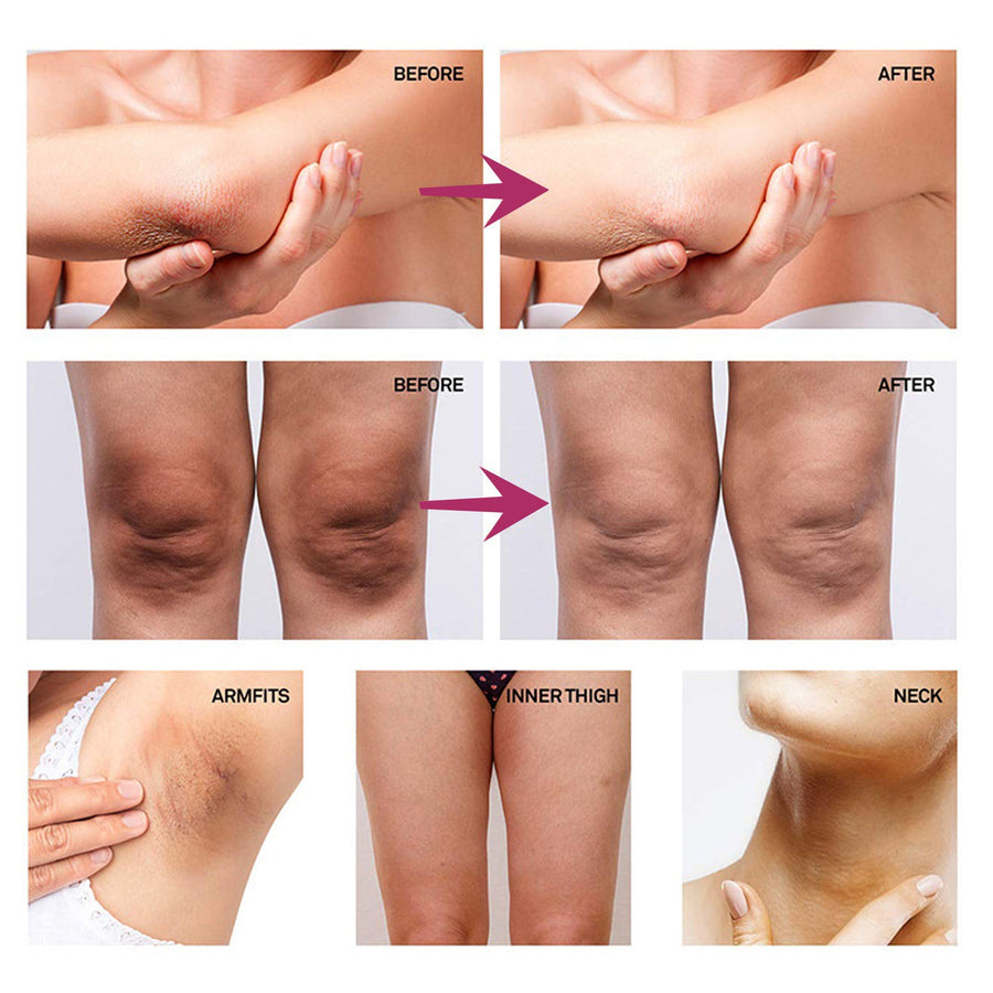 Underarm Whitening Cream for Dark Spots & Uneven Skin Tone