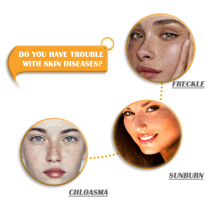 Kojic Acid Soap for Dark Spots & Acne Scars