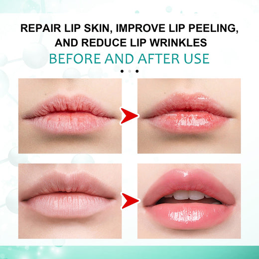 Repair Lip Liquid Dressing for Peeling, Dry Lip Lines