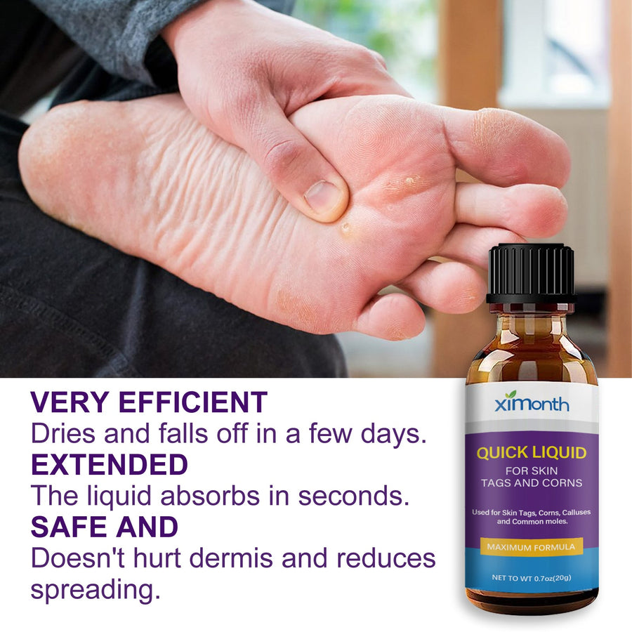 Skin Tag and Wart Removal Liquid — Results in Days