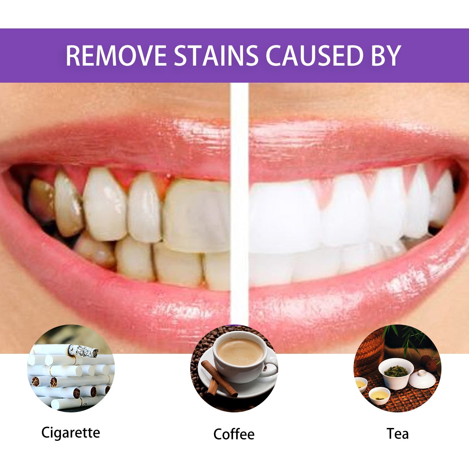 Clinical before/after comparison showing gum color transformation and tooth whitening results with lifestyle smile imagery