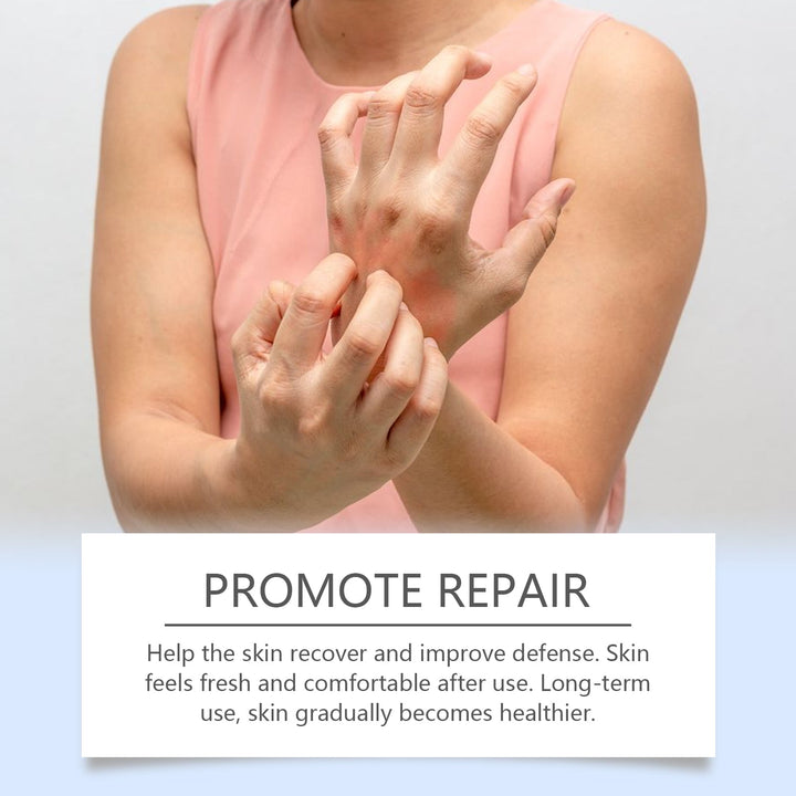 Bee Venom Skin Care Spray for Dry Skin Relief