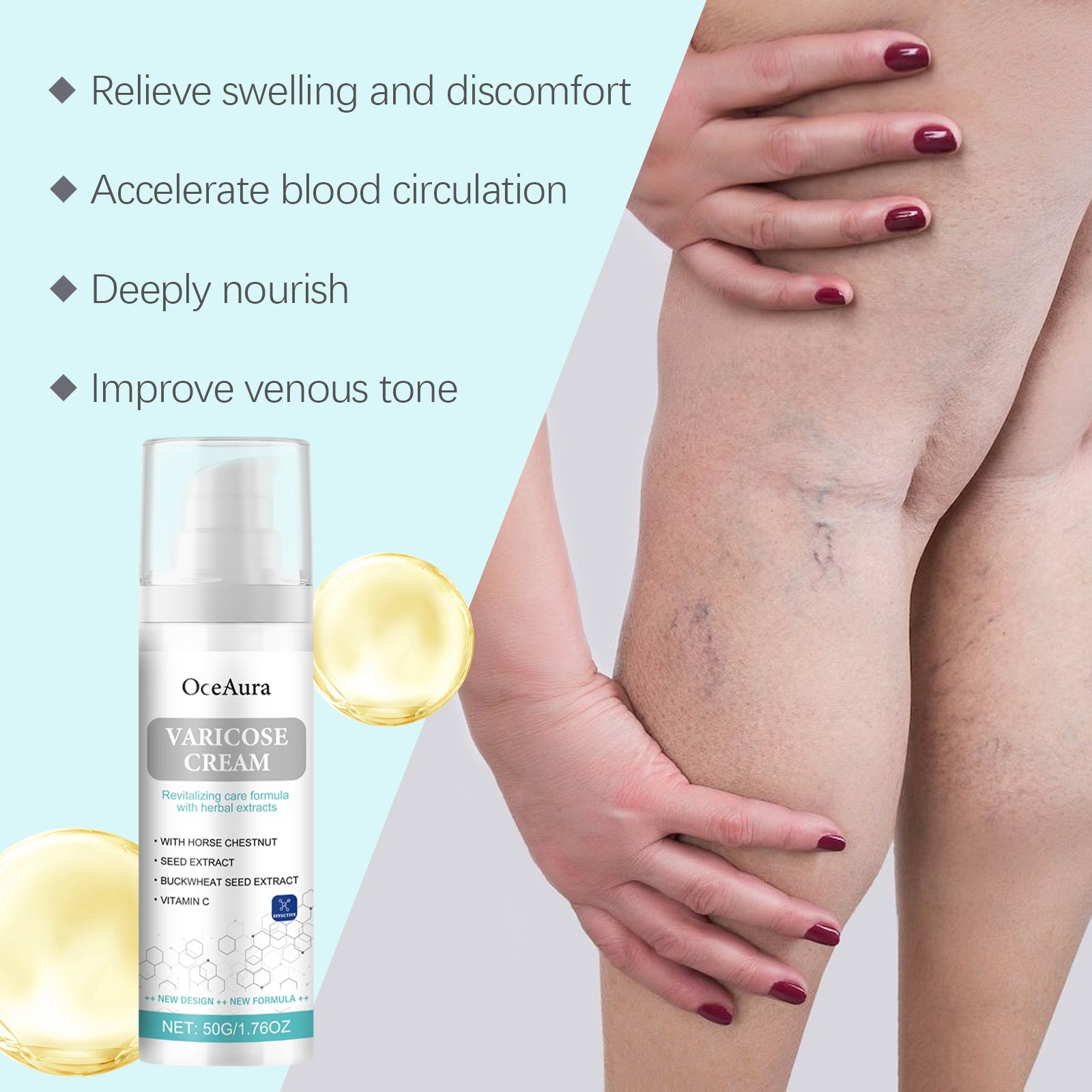 Leg with visible varicose veins on bright turquoise background with product bottle and packaging on left side
