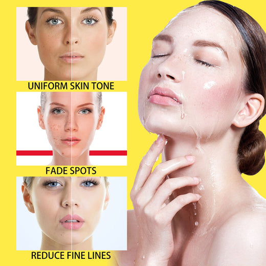 Vitamin C Serum for Dark Spots & Uneven Skin Tone