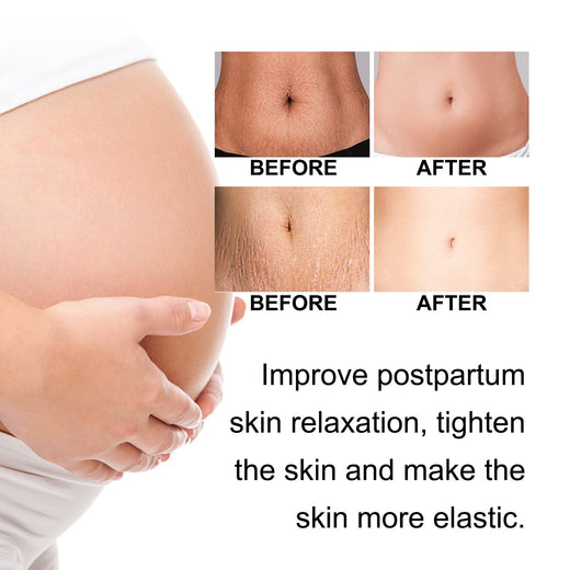 Postpartum Body Cream for Loose Skin & Fine Lines
