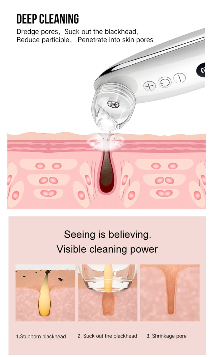 Electric Blackhead Remover with 10x Camera — Visible Pore