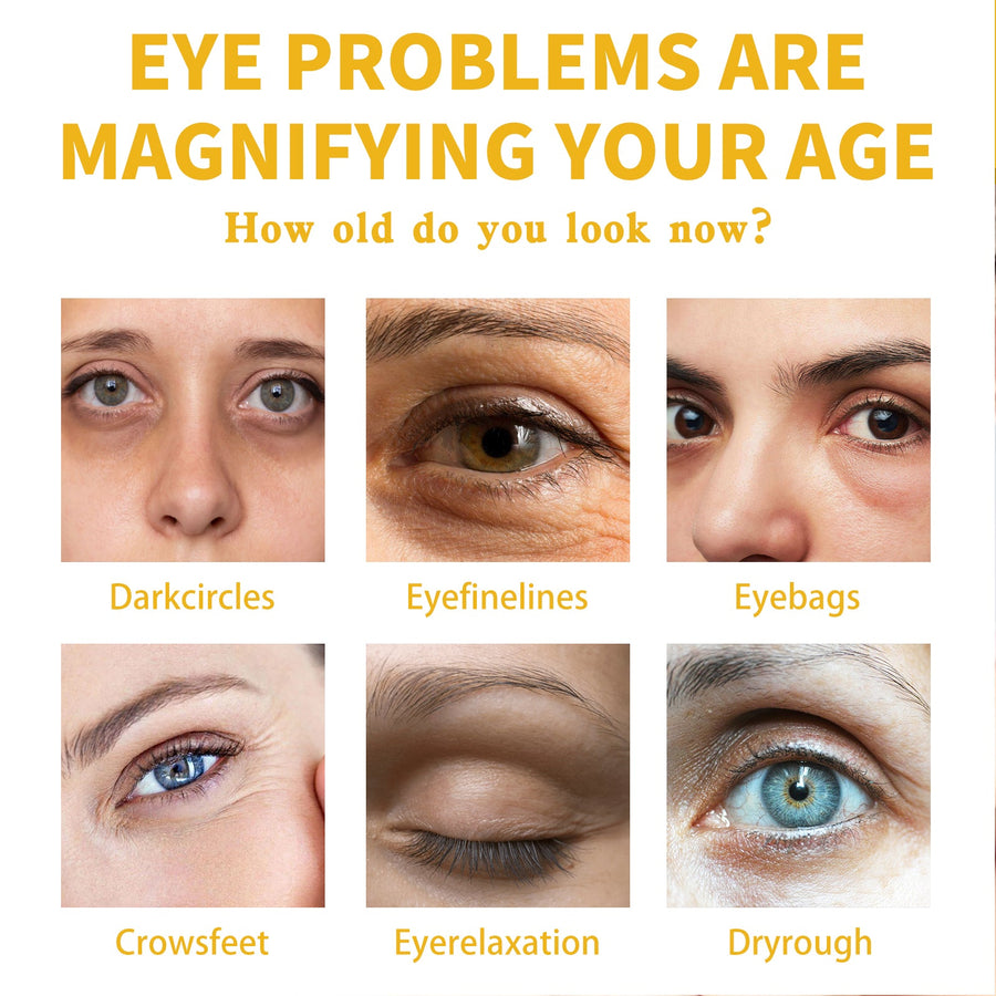 Vitamin E Eye Cream for Dark Circles & Crow's Feet