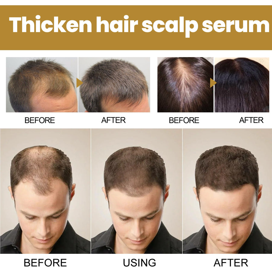 Scalp Cleansing Shampoo for Fuller-Looking, Thicker Hair