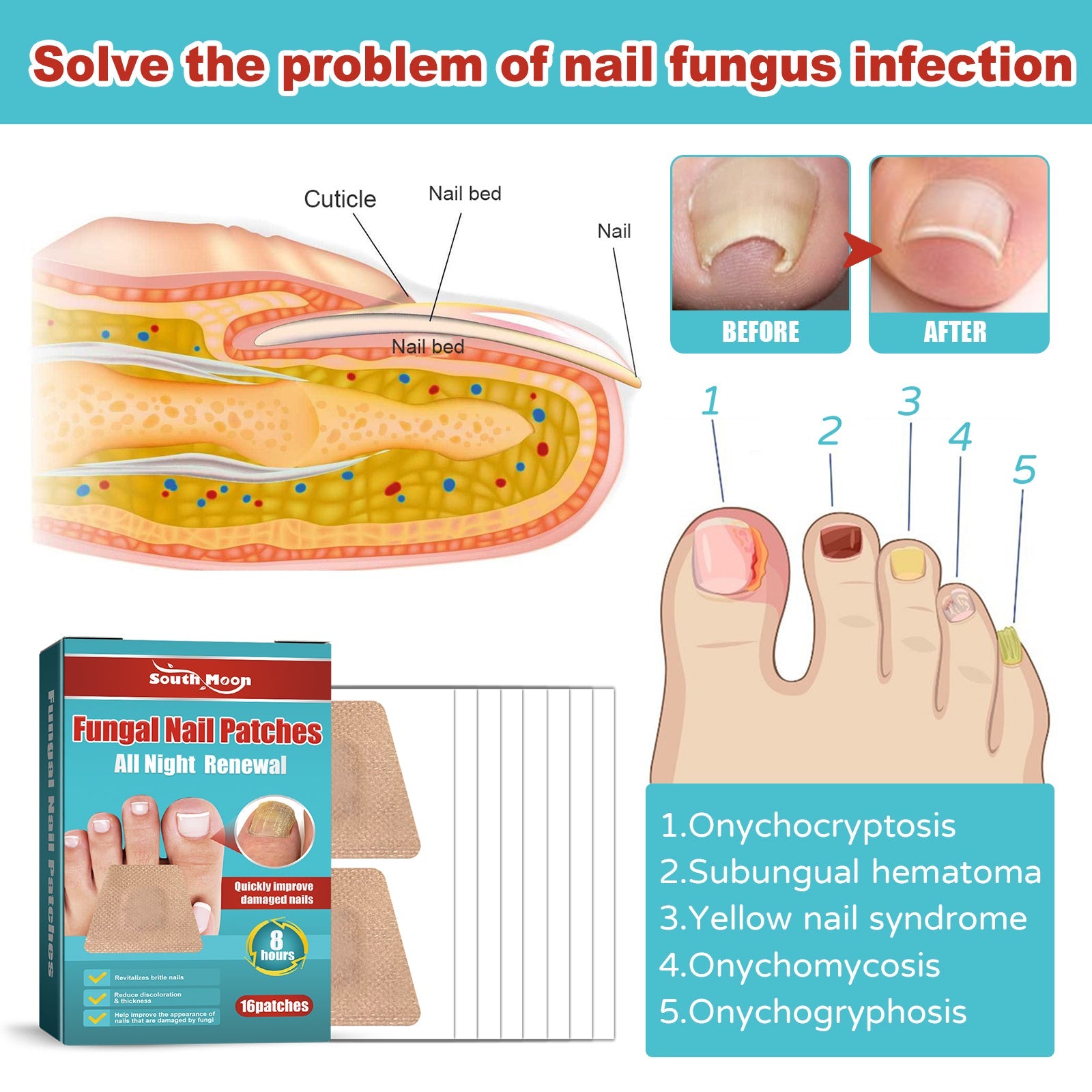 Before/after nail comparison showing fungal infection transformation with applied patches displayed