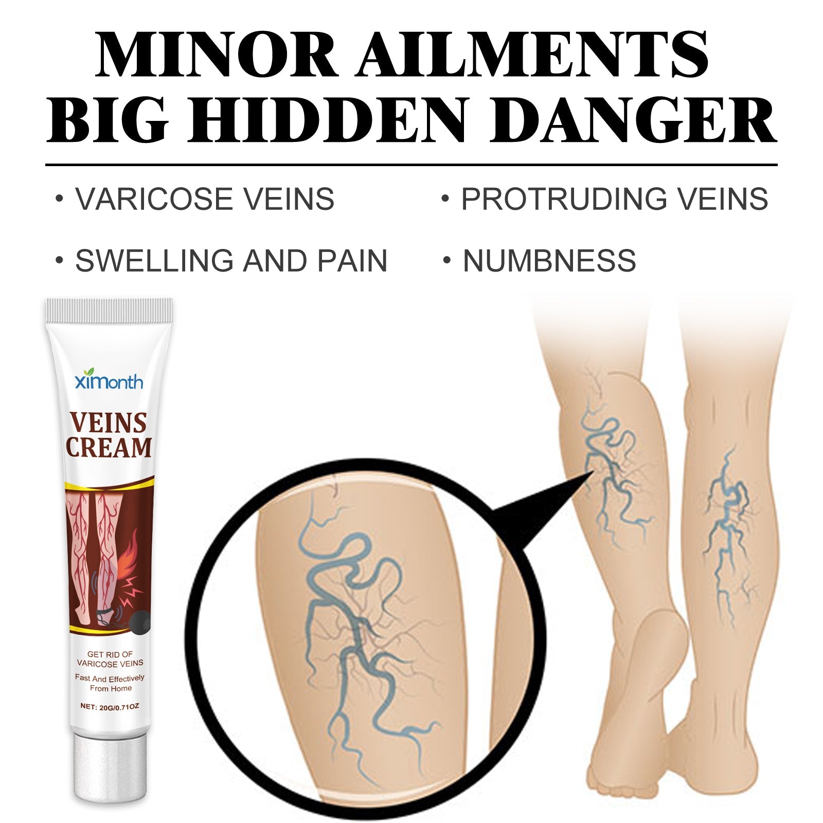Lifestyle image with before/after vein comparison and healthy smooth legs post-treatment