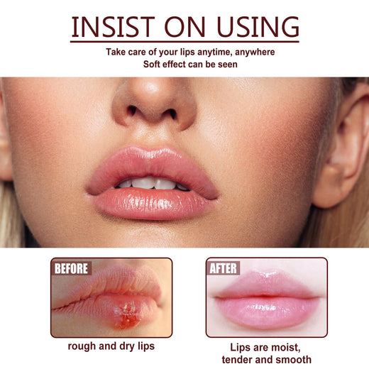 Lip Repair Cream for Chapped Lips & Cold Sore Relief