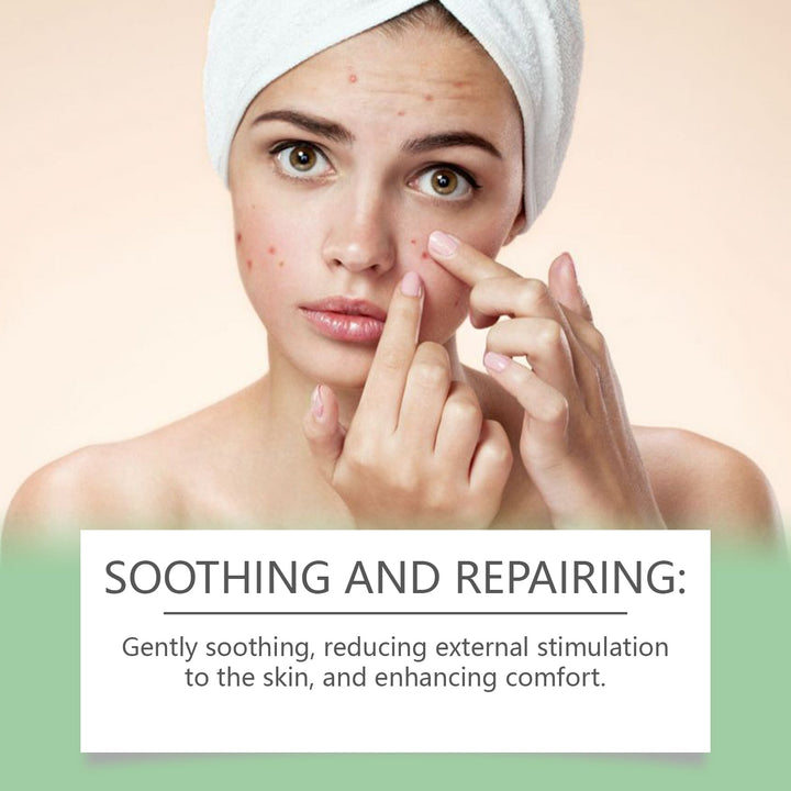 Soursop Face Oil Serum for Dry, Irritated Skin Relief
