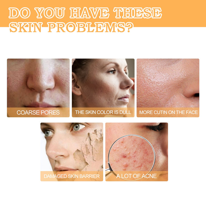 Glycolic Acid 7% Toner for Acne Marks & Uneven Skin